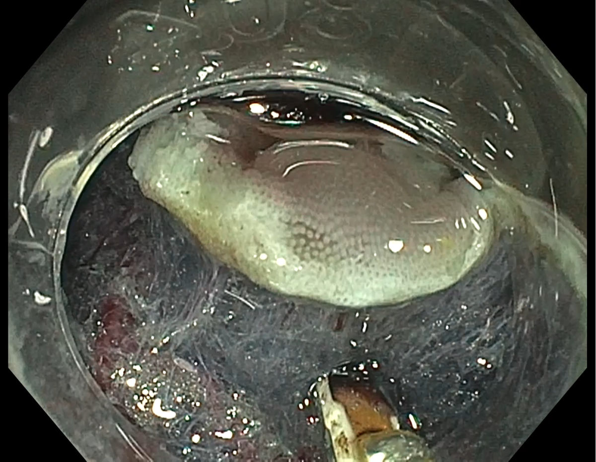 Submucosa